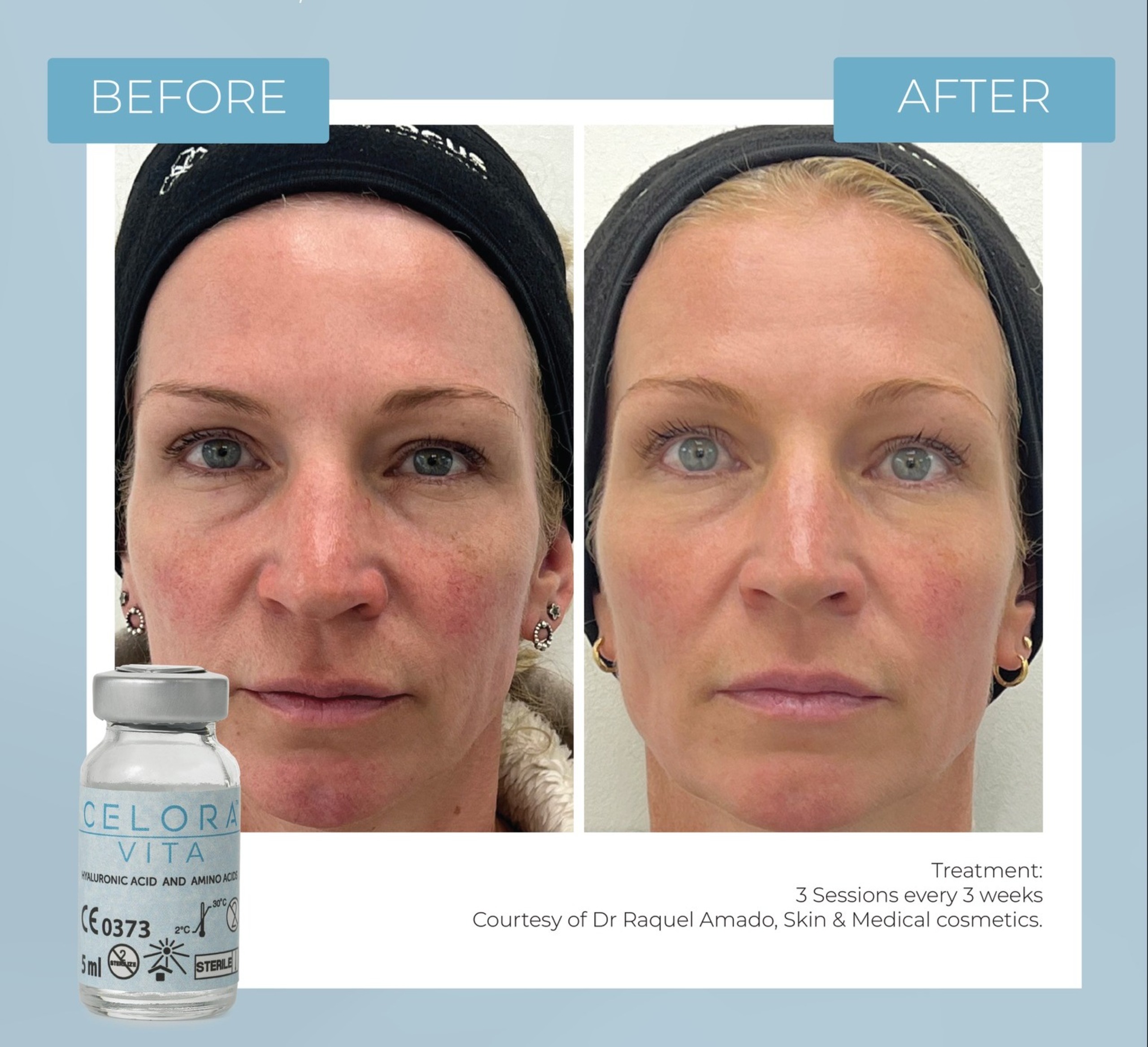 B&A (1) (1)