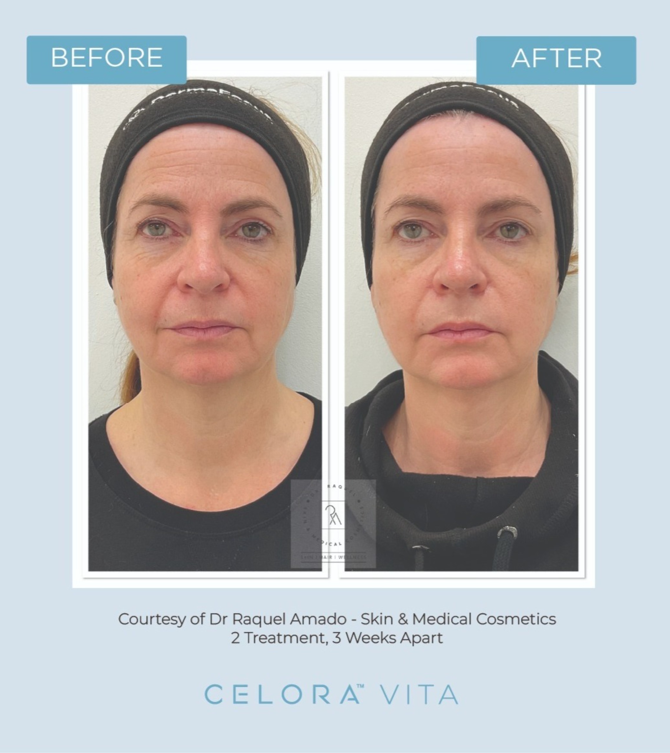 B&A (3) (1) (1)